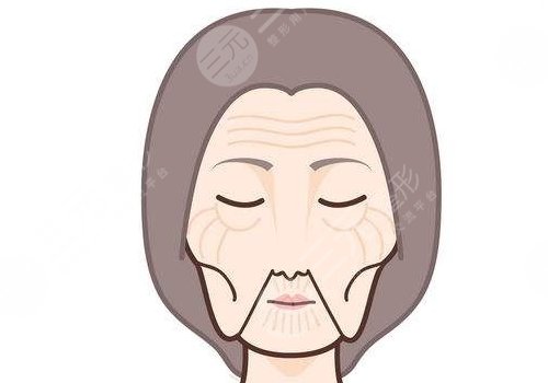 法令纹填充玻尿酸多少钱？