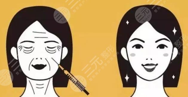 筋膜提升的注意事项