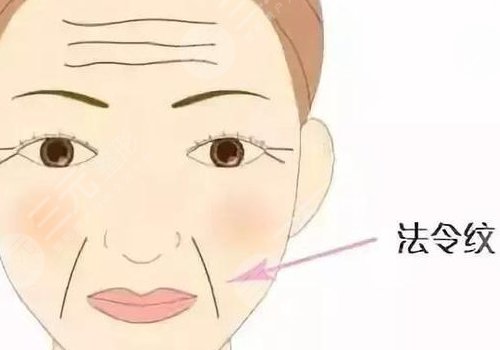 艾莉薇玻尿酸有几种型号？
