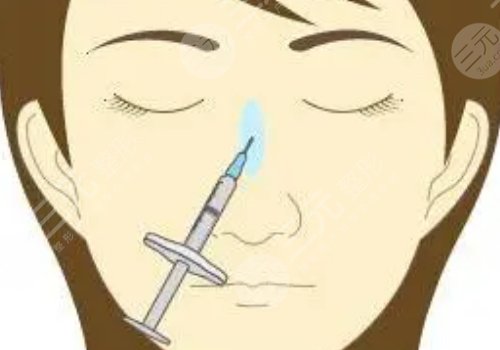 艾莉薇玻尿酸有几种型号？