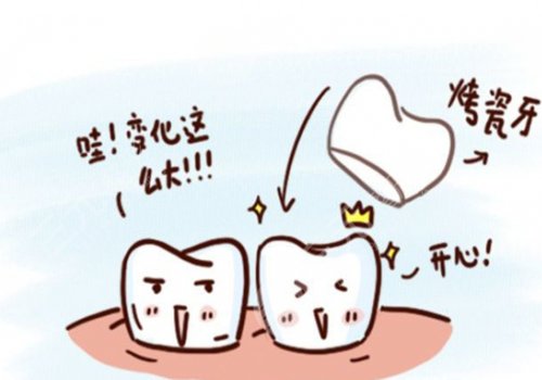 烤瓷牙多少钱一颗？