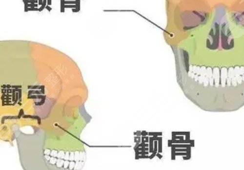 颧骨颧弓内推大概手术费用是多少？