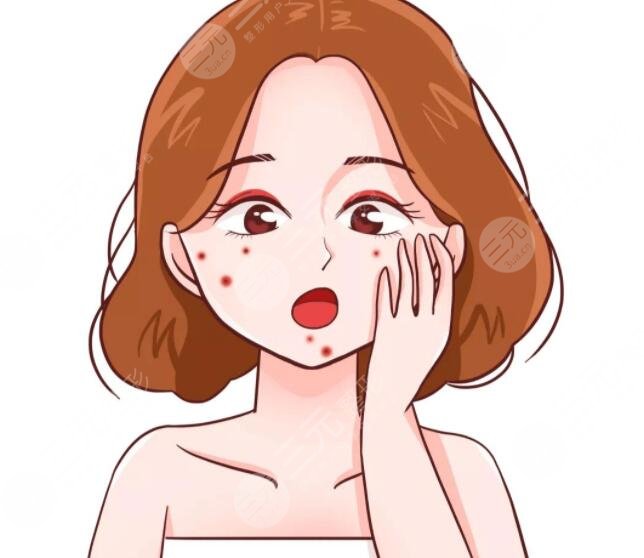脸上痤疮怎么样治疗效果好？药物、激光、医美多种方案结合起来效果佳！