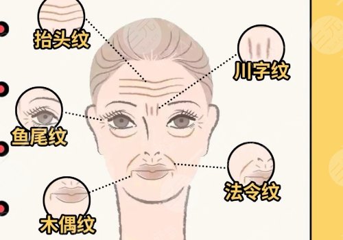 脸上皱纹怎么去除？