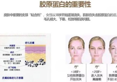 脸上皱纹怎么去除？