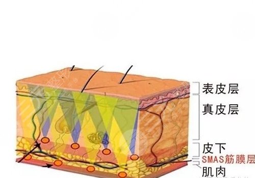 热拉提面部紧致真的有效果吗？