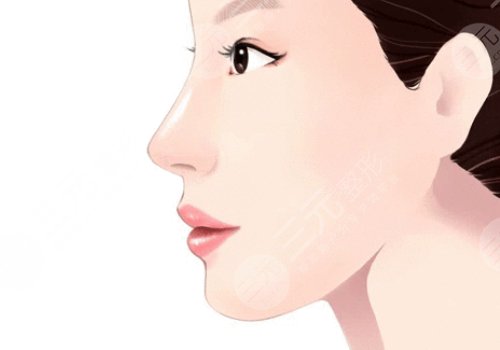 整鼻子鼻翼缩小多少钱？