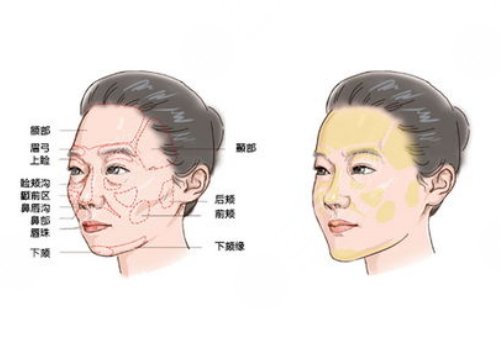 脸部填充用什么填充好?