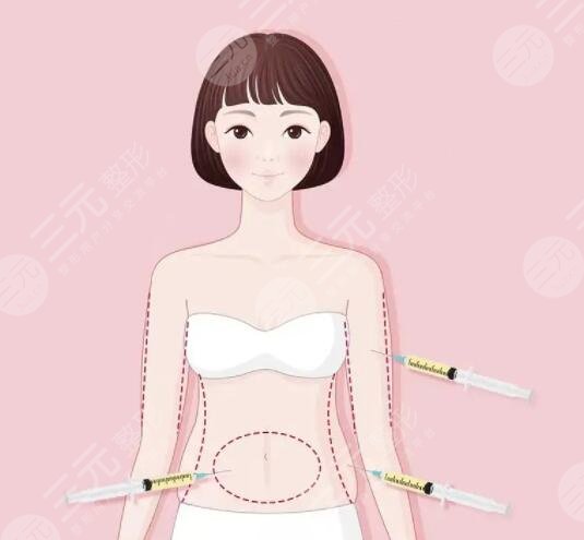 抽脂手术对身体有什么副作用？或许看完后你对吸脂有新的认知！