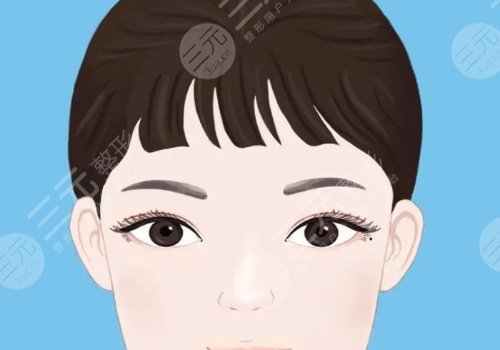 开眼角会有疤痕吗？