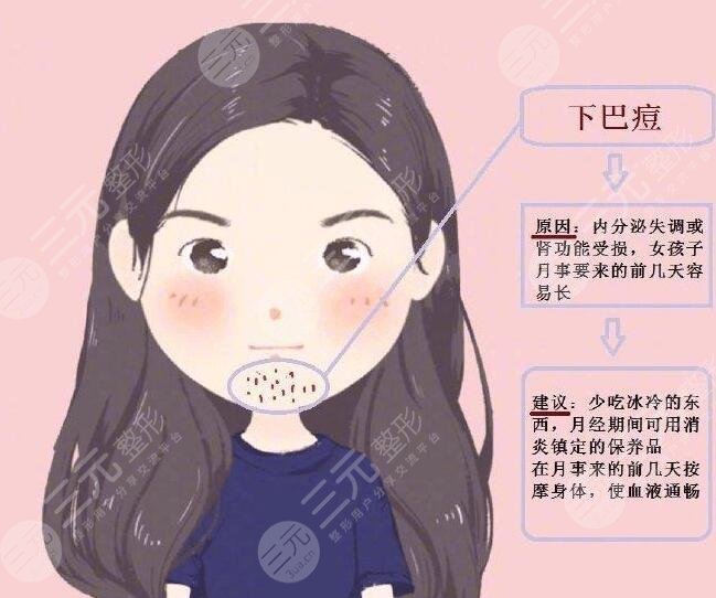内分泌失调