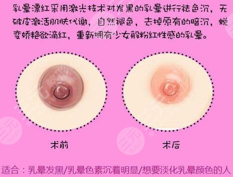 /uploads/allimg/c230628/1DO1F01M3F-14317.jpg