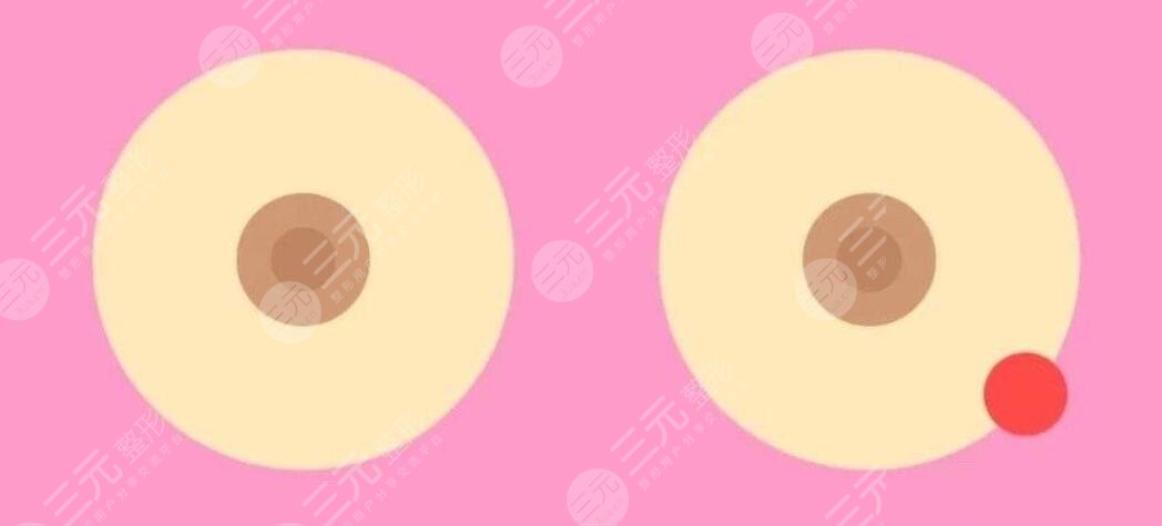 乳晕