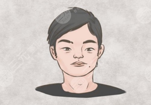 山根有横纹是怎么回事？