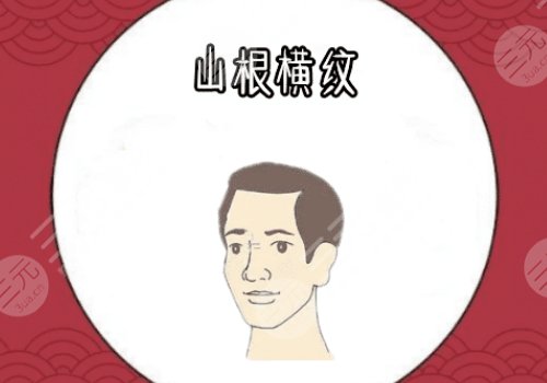 山根有横纹是怎么回事？