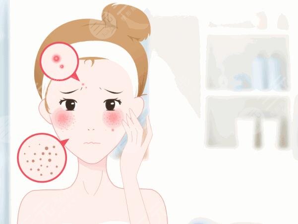 怎么样祛痘疤效果好？这4种小技巧操作简单见效快！激光祛疤是优选！