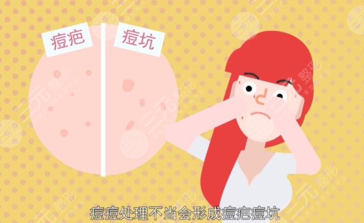 怎么样祛痘疤效果好?