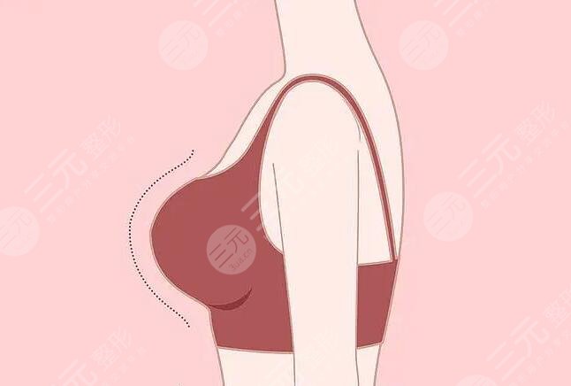 乳房大小不一怎么办?