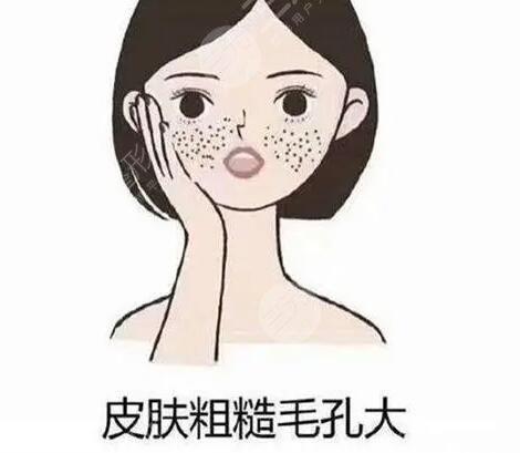 脸上的皮肤很粗糙怎么办?