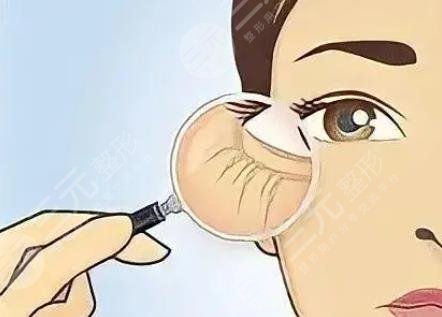 眼部提升术