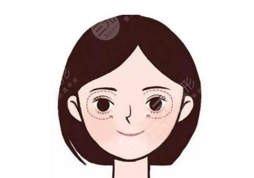 眼尾下垂做什么手术好？