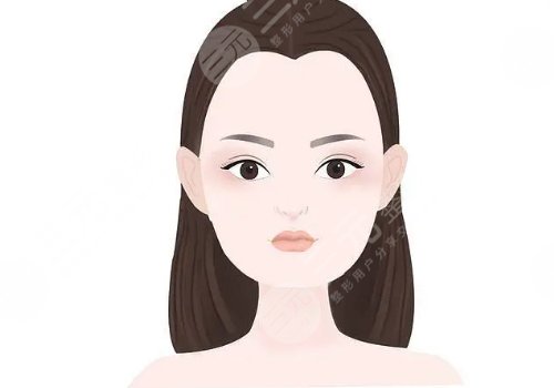眼尾下垂做什么手术好？