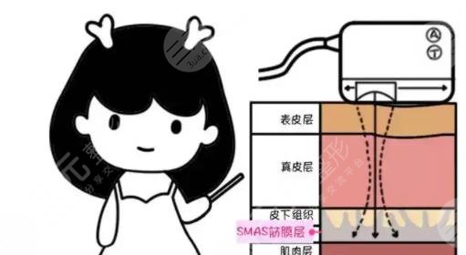 超声刀