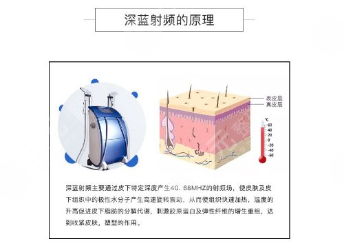 深蓝射频做一次有效果吗？