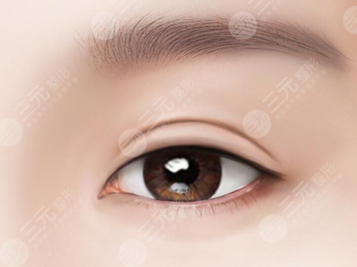 双眼皮手术恢复时间是多久？如何恢复的快？教给你这些护理方法，恢复速度加倍~