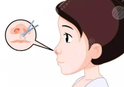 爱贝芙隆鼻可以维持多久？