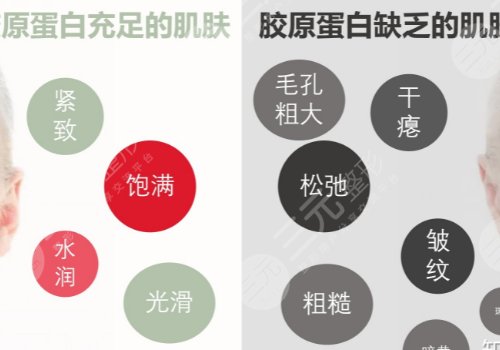 胶原蛋白对脸皮松弛有没有用?