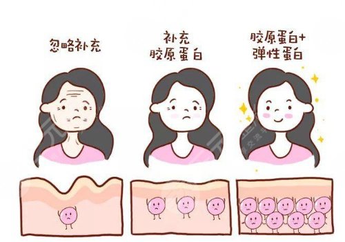 胶原蛋白对脸皮松弛有没有用?