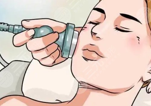 热拉提plus做一次可以维持多久？