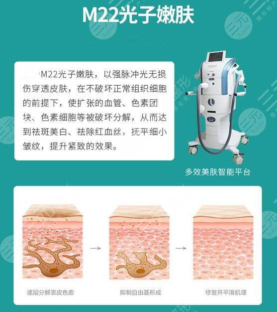 治疗脸部红血丝的方法有哪些？3种方案解读，白净美肌这样养成！