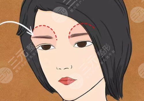 爱贝芙注射眉骨什么时候有效果？