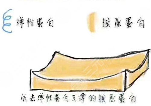 胶原蛋白填充泪沟维持多久？
