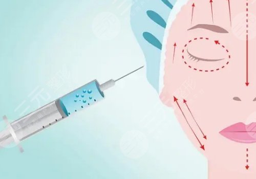 玻尿酸隆鼻后需要注意什么?