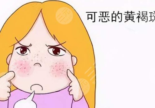 激光祛斑后反黑怎样能快速消除?