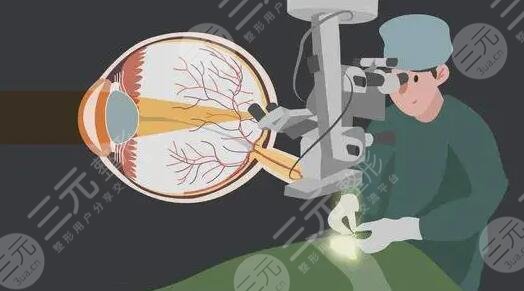 激光手术治疗近视眼的效果及危害有哪些？就是是利大于弊还是弊大于利？