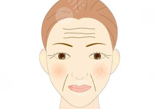 如何去除抬头纹？