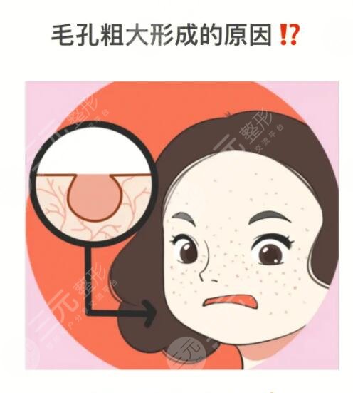 在缩小毛孔前需要注意什么?