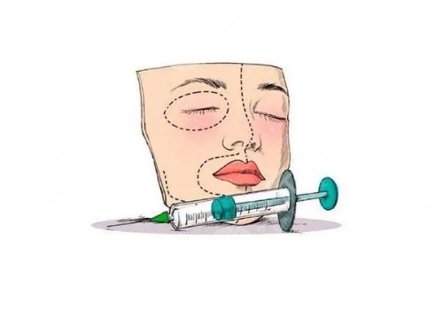 婕尔玻尿酸可以打哪些部位？