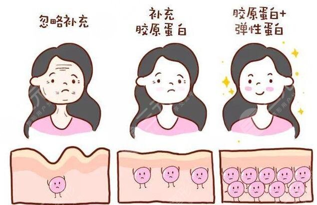 注射胶原蛋白好不好？注射胶原蛋白可以维持多长时间？术后怎么护理？