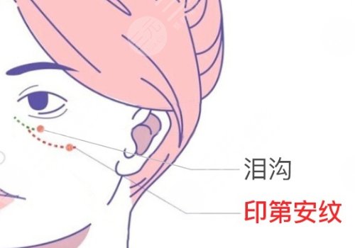 泪沟凹陷怎么解决好？