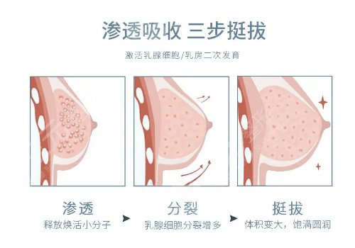 玻尿酸丰胸的作用与危害有哪些？