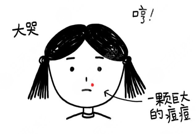 维生素e去痘印