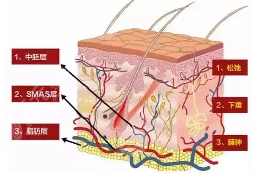 黄金热拉提做一次的价格是多少？
