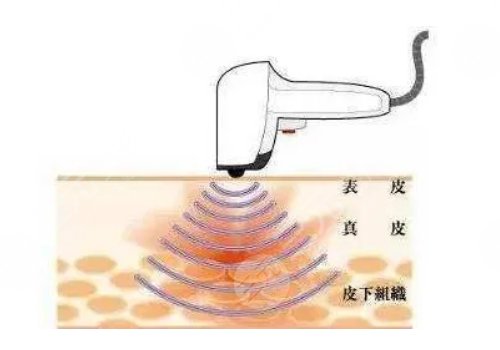 黄金热拉提2.0做一次能维持多久?