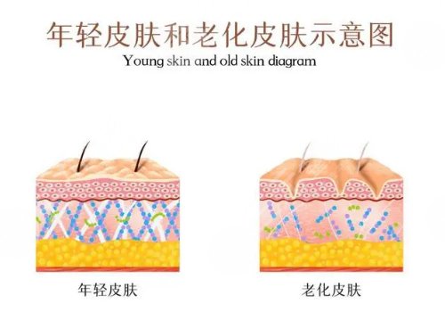 黄金热拉提和热拉提plus的区别
