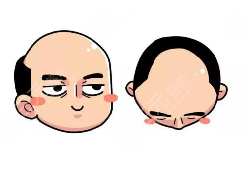 纹发的副作用及危害有什么？